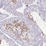SPAG1 Antibody in Immunohistochemistry (IHC)