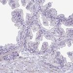 SPAG1 Antibody in Immunohistochemistry (IHC)