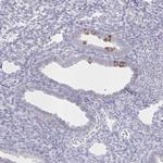 SPAG1 Antibody in Immunohistochemistry (IHC)
