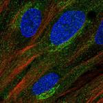MURF2 Polyclonal Antibody