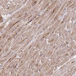 MURF2 Antibody in Immunohistochemistry (Paraffin) (IHC (P))
