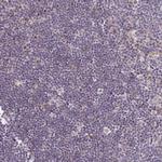 MURF2 Antibody in Immunohistochemistry (Paraffin) (IHC (P))