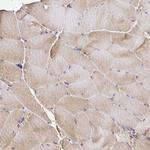 MURF2 Antibody in Immunohistochemistry (Paraffin) (IHC (P))