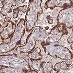 KLHL20 Polyclonal Antibody