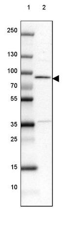 METTL13 Antibody in Western Blot (WB)