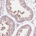 TDIF2 Polyclonal Antibody