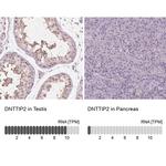 TDIF2 Antibody in Immunohistochemistry (IHC)