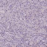 TDIF2 Antibody in Immunohistochemistry (IHC)
