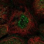 CCRN4L Polyclonal Antibody