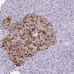 SCG3 Antibody in Immunohistochemistry (Paraffin) (IHC (P))