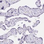 SCG3 Antibody in Immunohistochemistry (Paraffin) (IHC (P))
