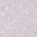 SCG3 Antibody in Immunohistochemistry (Paraffin) (IHC (P))
