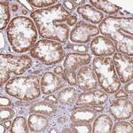 DLEU7 Polyclonal Antibody