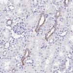 MON1A Polyclonal Antibody
