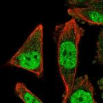 ZNF414 Polyclonal Antibody