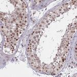 ZNF414 Antibody in Immunohistochemistry (Paraffin) (IHC (P))
