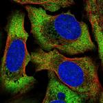 ATP6AP1L Polyclonal Antibody