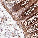ATP6AP1L Antibody in Immunohistochemistry (Paraffin) (IHC (P))