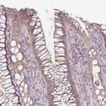 UBL3 Antibody in Immunohistochemistry (IHC)