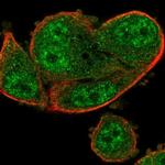 ARRDC2 Polyclonal Antibody