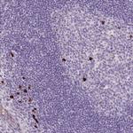 ARRDC2 Antibody in Immunohistochemistry (Paraffin) (IHC (P))