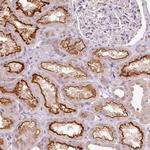 TMEM37 Antibody in Immunohistochemistry (Paraffin) (IHC (P))
