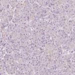 TMEM37 Antibody in Immunohistochemistry (IHC)