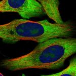 RPL10A Polyclonal Antibody