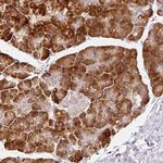 RPL10A Antibody in Immunohistochemistry (Paraffin) (IHC (P))