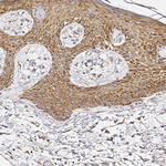 RPL10A Antibody in Immunohistochemistry (Paraffin) (IHC (P))