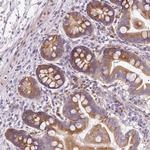 RPL10A Antibody in Immunohistochemistry (Paraffin) (IHC (P))