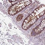 ADAMTSL2 Polyclonal Antibody