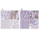 BSND Polyclonal Antibody