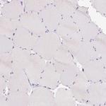 BSND Antibody in Immunohistochemistry (IHC)