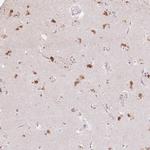 Clavesin-1 Polyclonal Antibody
