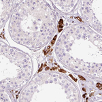 SH2D6 Antibody in Immunohistochemistry (Paraffin) (IHC (P))