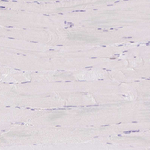 SH2D6 Antibody in Immunohistochemistry (Paraffin) (IHC (P))