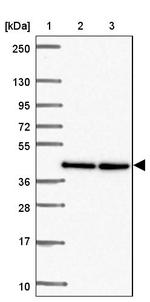 TWF2 Antibody in Western Blot (WB)