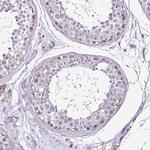 DPAGT1 Polyclonal Antibody