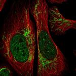 RCAN2 Polyclonal Antibody