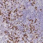RCAN2 Antibody in Immunohistochemistry (Paraffin) (IHC (P))