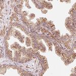 PP14B Polyclonal Antibody