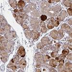 TMCC1 Polyclonal Antibody