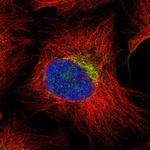 Hemicentin 2 Polyclonal Antibody