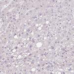 Hemicentin 2 Antibody in Immunohistochemistry (Paraffin) (IHC (P))