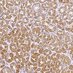 Hemicentin 2 Antibody in Immunohistochemistry (Paraffin) (IHC (P))