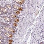 Hemicentin 2 Antibody in Immunohistochemistry (IHC)