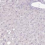 Hemicentin 2 Antibody in Immunohistochemistry (IHC)