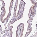 C19orf63 Polyclonal Antibody