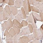 C19orf63 Antibody in Immunohistochemistry (Paraffin) (IHC (P))